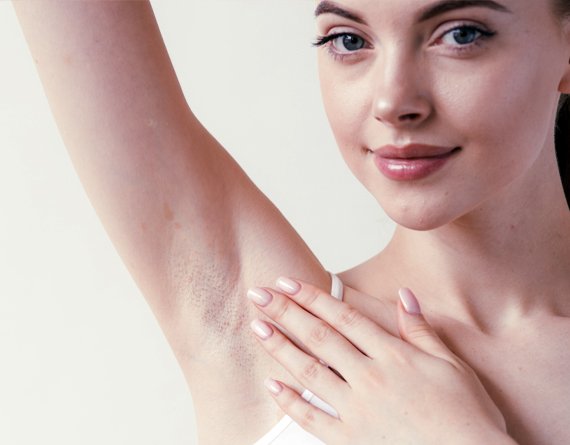 Excessive Sweating (Axilla) Treatment - Nur Beauty By Dr. Nur A.K.